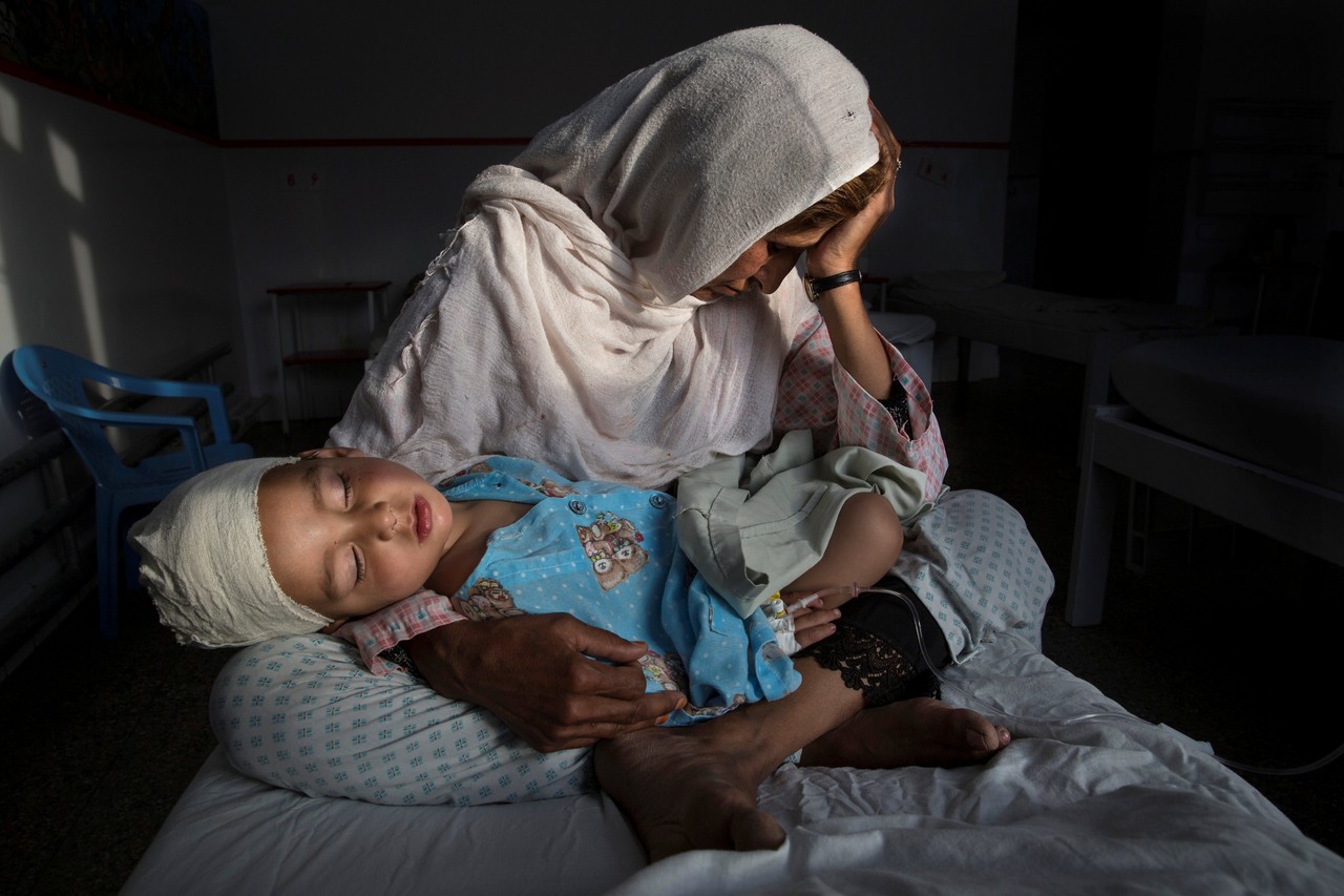 在喀布尔，一名妇女抱着她两岁的外甥。这个孩子在一起炸弹爆炸中受伤。