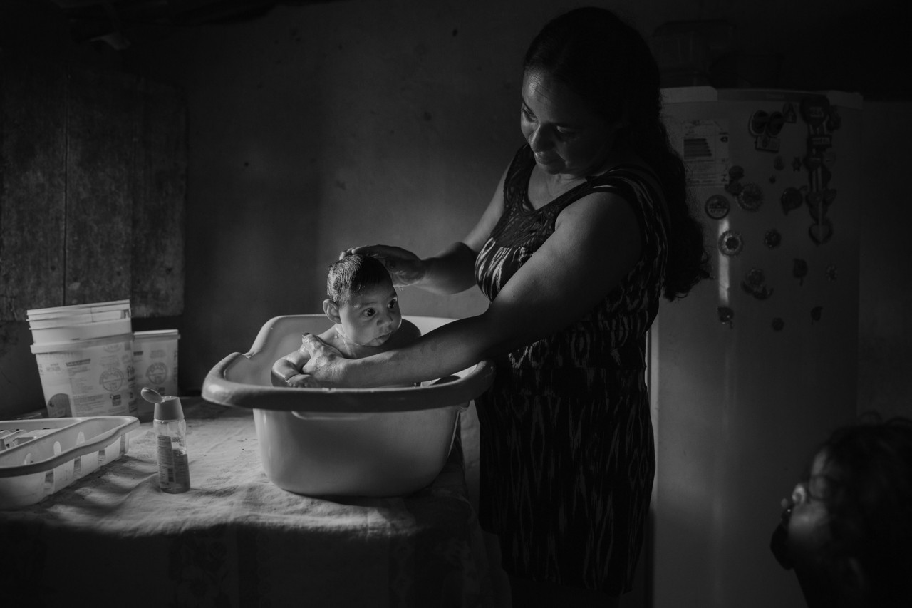 巴西Sao Vicente do Serido乡村地区，30岁的Adriana Cordeiro Soares在家中给她三个月大的儿子洗澡。这名男婴因胎儿期感染寨卡病毒，出生时就患有“小头症”。